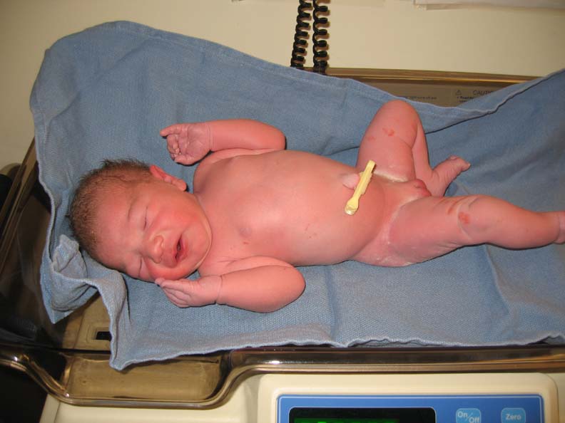 Zoey Getting Weight day 1